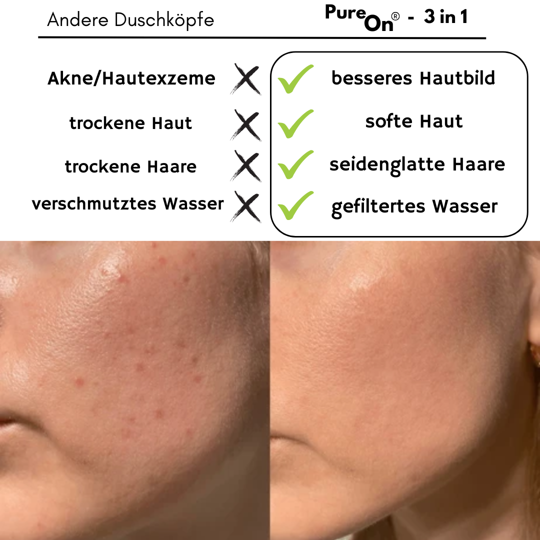 Pure On™ - 3in1 Duschkopf mit Filter (das Original)